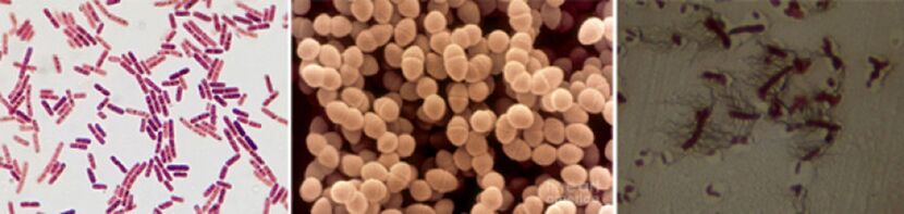 E. coli, faecal enterococcus and proteus are the main agents responsible for chronic bacterial prostatitis